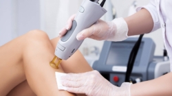 Tout ce que vous devez savoir sur l’épilation au laser