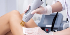 Tout ce que vous devez savoir sur l’épilation au laser