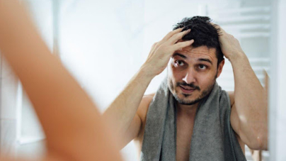 Greffe de cheveux Turquie :Quels sont les points à considérer après la greffe de cheveux ?